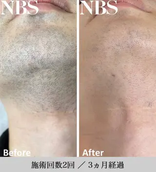 メンズ estheticsalon Pleroma【プレローマ】所属・【脱毛･美肌サロン】 Pleromaのエステ・リラクイメージ
