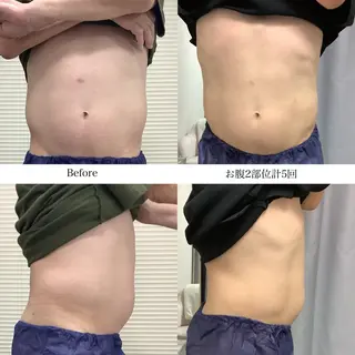 冷却専門店 SLARIのエステ・リラクイメージ