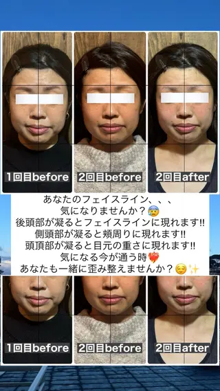 💎後悔させない小顔 矯正💎イトヤマ🌱のエステ・リラクイメージ