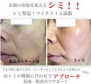 private salon Dea_maris シュガーリング&パーソナルボディケア所属・シミ改善・韓国肌管理 ボディメイク痩身のその他イメージ