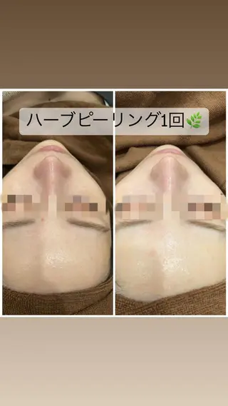 セミロング カラー パーマ ヘアアレンジ メンズ キッズ ネイル マツエク・マツパ アイブロウ Amaryllis 🌹松本のエステ・リラクイメージ