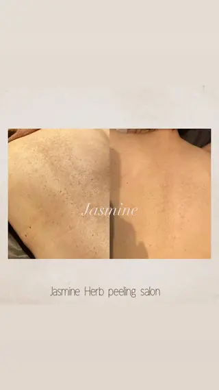 Jasmine所属・Jasmine herbのエステ・リラクイメージ