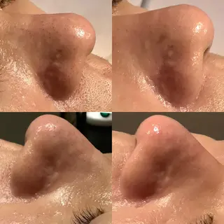 脱毛&エステサロン JIGGLY武蔵小山のエステ・リラクイメージ