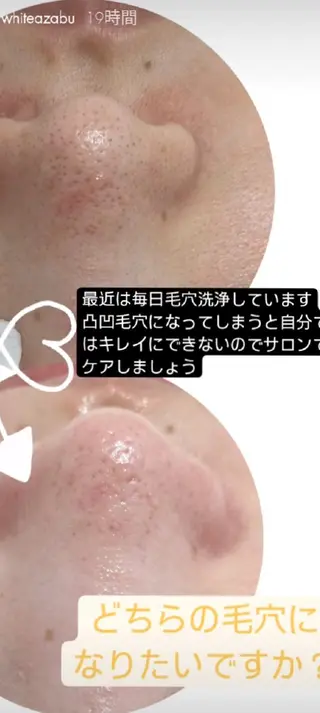 ホワイトアザブ WhiteAzabuのマツエク・マツパデザイン