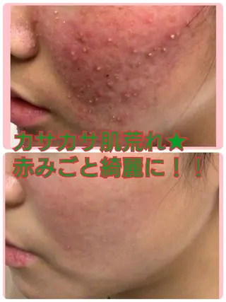 ハーブピーリング 専門店Kikkaのエステ・リラクイメージ