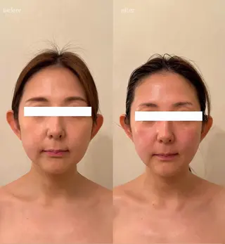 小顔×痩身専門サロンCLORE浦和店所属・石川 彩花のエステ・リラクイメージ