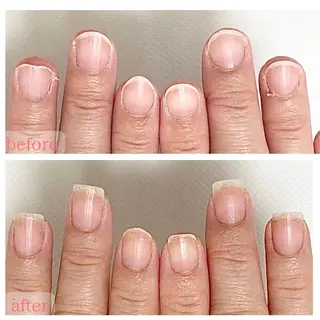 ネイル 深爪・巻き爪 専門サンセリテのネイルデザイン