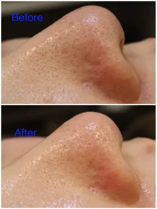 ANRIRE (アンリール)のエステ・リラクイメージ