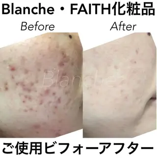 ショート カラー パーマ ヘアアレンジ ネイル マツエク・マツパ 都度払い肌質改善 &脱毛Blancheのエステ・リラクイメージ