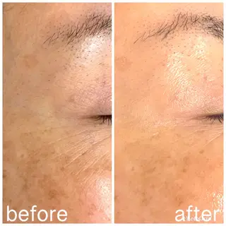 aimer beautyのエステ・リラクイメージ