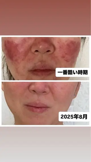 Binosu所属・エンダモロジー BINOSUのエステ・リラクイメージ