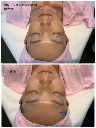 リラクゼーションエステサロン🌺肌質改善イアリイ所属・肌質再生 〜イア🌺リイ〜のエステ・リラクイメージ