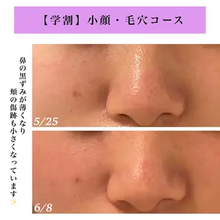 Bellesthe (ベルエステ)のエステ・リラクイメージ