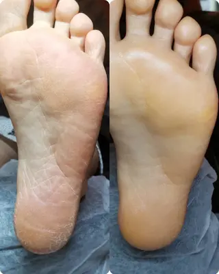 ネイル ROUN' 齋藤のエステ・リラクイメージ