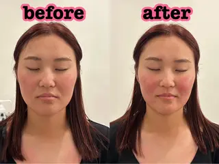 美容鍼灸Solana所属・小櫻 唯のエステ・リラクイメージ