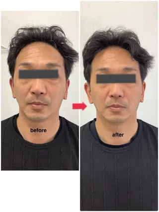 メディカルサロンドオフ所属・ハリサロンドオフ 美容鍼灸×小顔整体のエステ・リラクイメージ