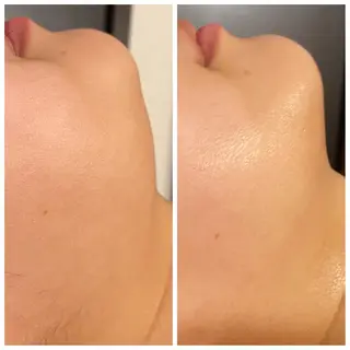 Mandarin Orange所属・毛穴から始める肌メン テマンダリンオレンジのエステ・リラクイメージ