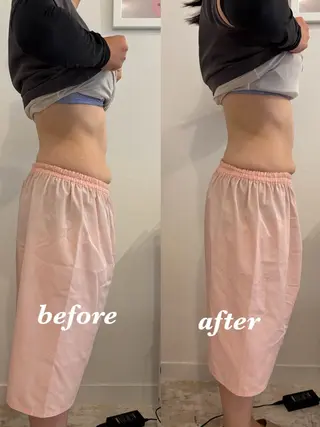 腸活サポート みなみののエステ・リラクイメージ