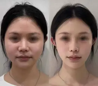 aliaハイフ&水光ジェットサロン所属・aliaハーブ水光店 エステティシャン募集のエステ・リラクイメージ