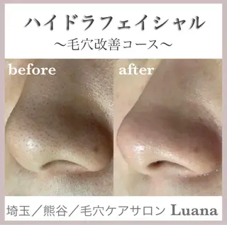 Luana アイラッシュ& フェイシャル所属・Luana eyelashのマツエク・マツパデザイン