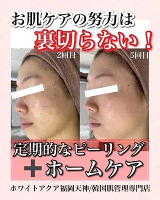 キッズ メンズ WHITEAQUA 福岡天神店のエステ・リラクイメージ