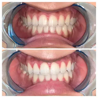 ネイル ヘアアレンジ ロング カラー メンズ マツエク・マツパ アイブロウ キッズ パーマ ライトビューティー 銀座店のエステ・リラクイメージ