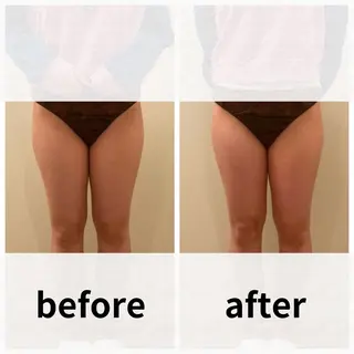 美容鍼/ヘッドスパ/ 💎さかもとのエステ・リラクイメージ