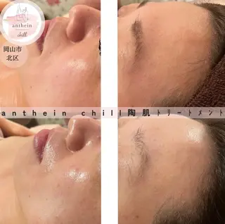 アンテインチル 山本のエステ・リラクイメージ