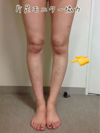 ニキビ・ 肌荒れ専門店のエステ・リラクイメージ