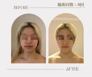 韓国式小顔コルギ BE-CUTE北参道のエステ・リラクイメージ