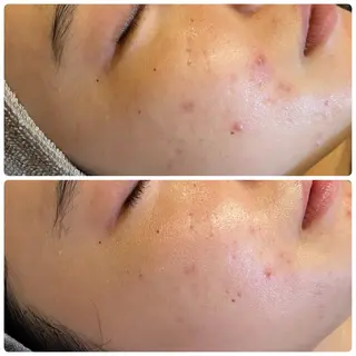 yellow.所属・yellow💛【 脱毛&フェイシャル】のエステ・リラクイメージ