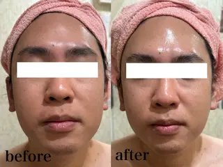 フェイシャル/脱毛 ジョアアンジェ　田中のエステ・リラクイメージ