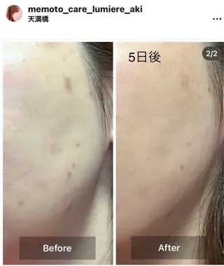 目元・まつパ・美肌フ ェイシャル谷町四丁目のマツエク・マツパデザイン