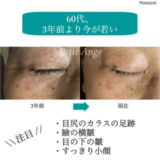 プチアンジェ所属・艶肌&小顔リフト❤︎ プチアンジェ茅ヶ崎のエステ・リラクイメージ