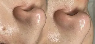 sii センター北 AIのエステ・リラクイメージ