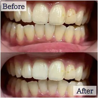 LBSホワイトニング 新宿店💝公式のその他イメージ