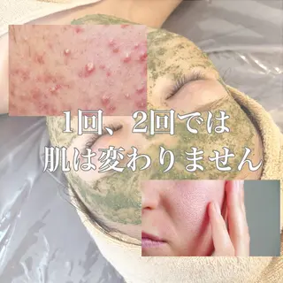 WHITE AQUA 北千住店のエステ・リラクイメージ