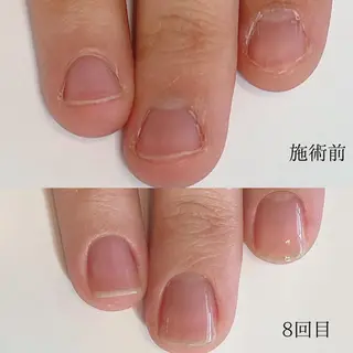 木村 千晴のネイルデザイン