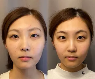 医療提携×美容整体 小顔ハイフピーリングのエステ・リラクイメージ