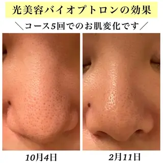 Bellesthe (ベルエステ)のエステ・リラクイメージ