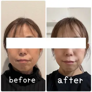 小顔と ヘッドスパのお店のエステ・リラクイメージ