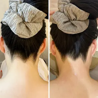 うなじ脱毛/美肌脱毛 LABELのエステ・リラクイメージ