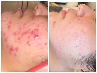 FLEUR大阪・整体 ・ハイフ・痩身・小顔のエステ・リラクイメージ