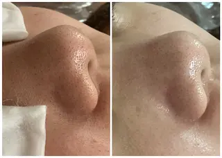 ize 横浜店のエステ・リラクイメージ