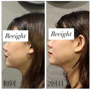 肌質改善専門 ハーブ /毛穴洗浄 リエイトのエステ・リラクイメージ