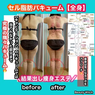 痩身/脱毛/ネイル HARUKAのエステ・リラクイメージ