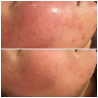 触れたくなる モテ肌へ...❤︎のエステ・リラクイメージ