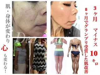 private salon Dea_maris シュガーリング&パーソナルボディケア所属・シミ改善・韓国肌管理 ボディメイク痩身のその他イメージ