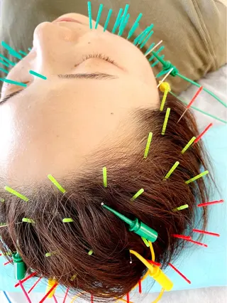 小顔美容鍼専門サロン 渋谷YZのエステ・リラクイメージ