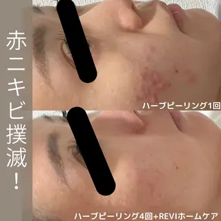 小林 千紘のエステ・リラクイメージ